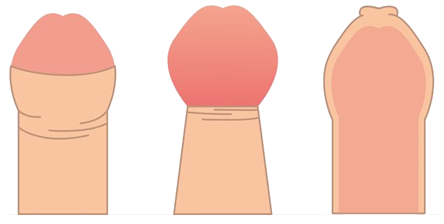 notion image